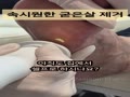 まだセルフで足の角質を管理していますか? これからは専門ショップで管理してください ㅣ大田BHP まだセルフで足の角質を管理していますか? これからは専門ショップで管理してください ㅣ大田BHP